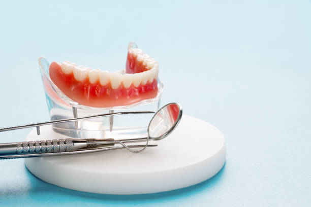 Dental Inlays and Onlays in Langley Park, MD